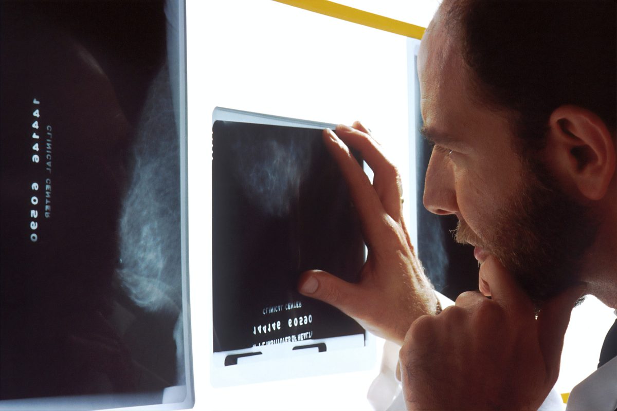 Co musisz wiedzieć przed wykonaniem tomografii komputerowej?